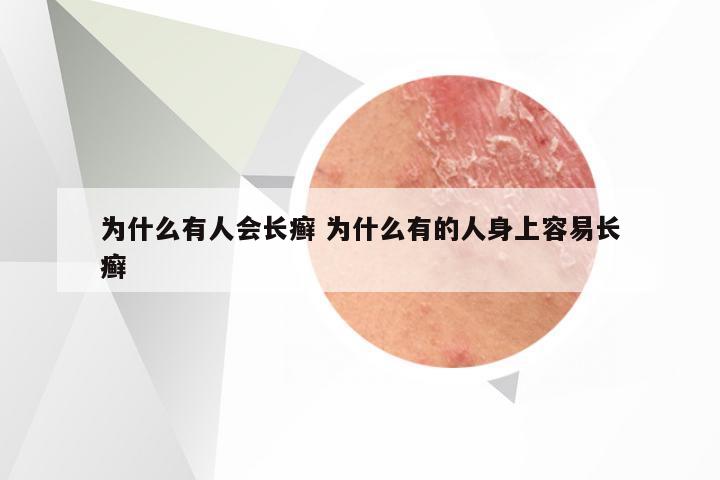为什么有人会长癣 为什么有的人身上容易长癣