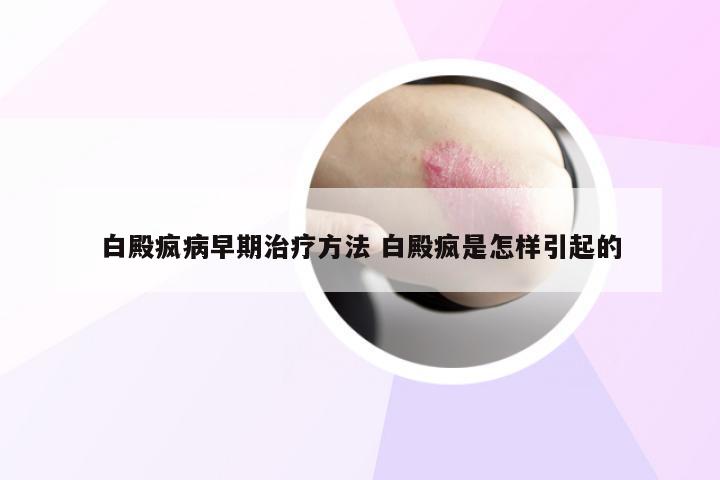 白殿疯病早期治疗方法 白殿疯是怎样引起的