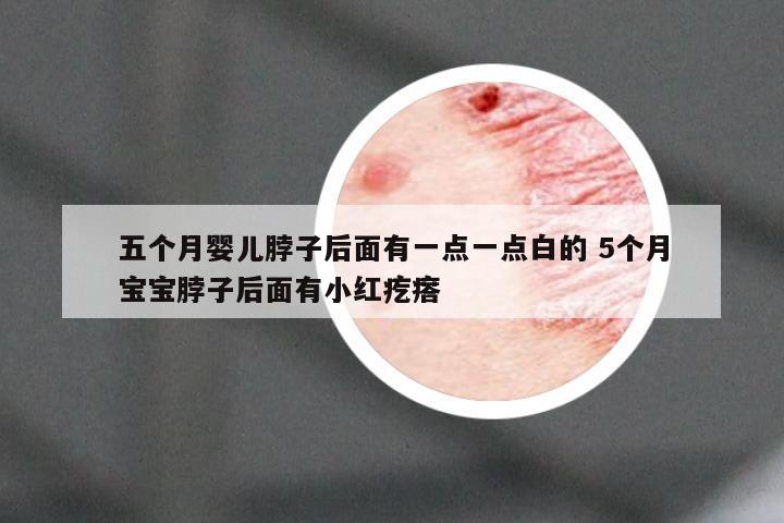 五个月婴儿脖子后面有一点一点白的 5个月宝宝脖子后面有小红疙瘩