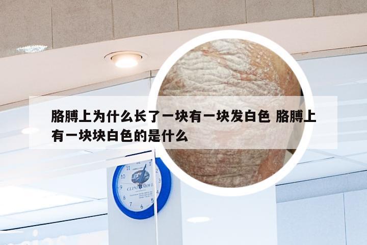 胳膊上为什么长了一块有一块发白色 胳膊上有一块块白色的是什么