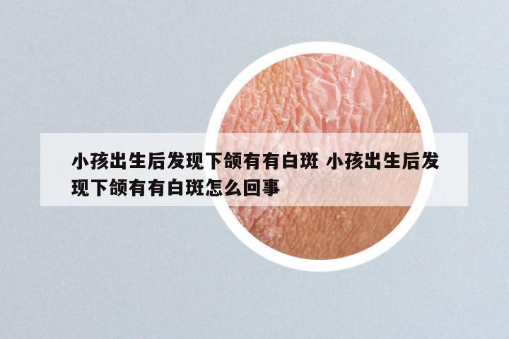 小孩出生后发现下颌有有白斑 小孩出生后发现下颌有有白斑怎么回事
