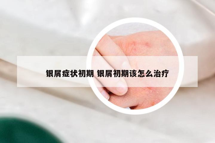 银屑症状初期 银屑初期该怎么治疗