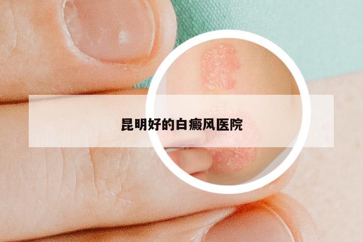 昆明好的白癜风医院