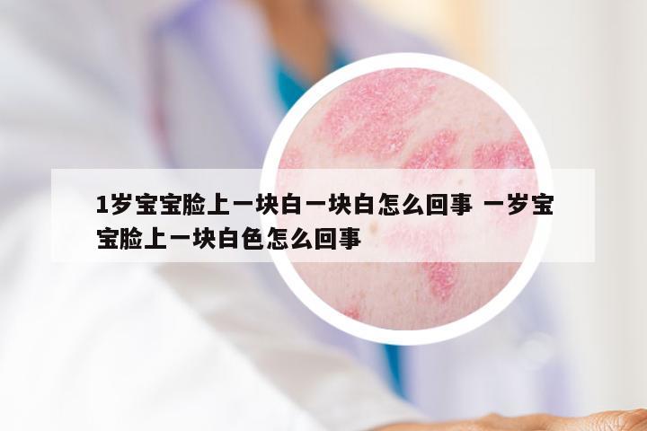 1岁宝宝脸上一块白一块白怎么回事 一岁宝宝脸上一块白色怎么回事