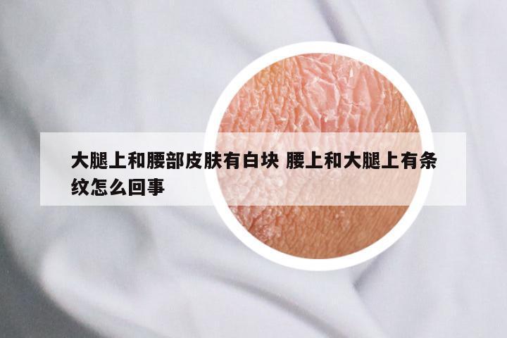 大腿上和腰部皮肤有白块 腰上和大腿上有条纹怎么回事