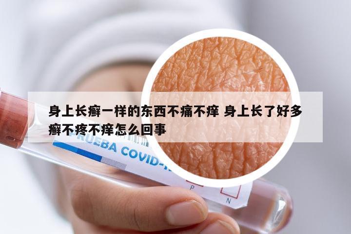 身上长癣一样的东西不痛不痒 身上长了好多癣不疼不痒怎么回事