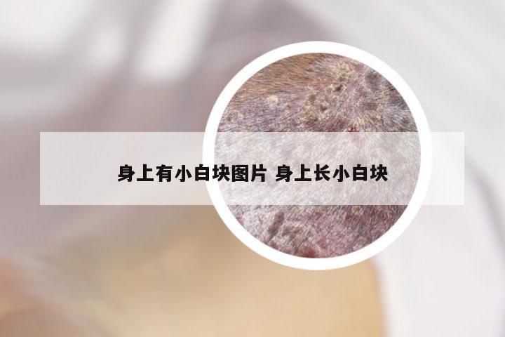 身上有小白块图片 身上长小白块