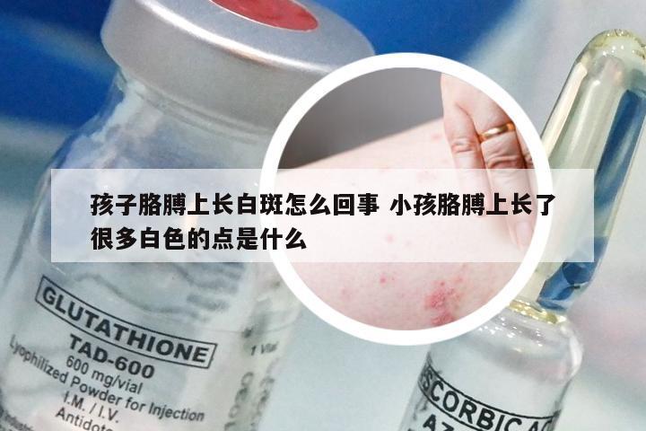 孩子胳膊上长白斑怎么回事 小孩胳膊上长了很多白色的点是什么