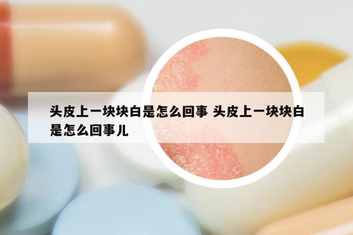 头皮上一块块白是怎么回事 头皮上一块块白是怎么回事儿