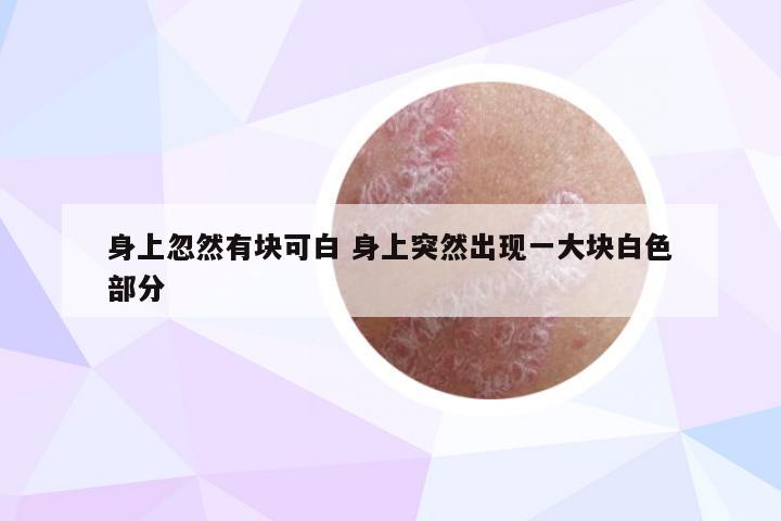 身上忽然有块可白 身上突然出现一大块白色部分