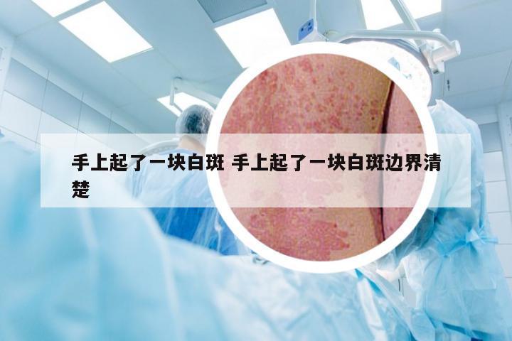 手上起了一块白斑 手上起了一块白斑边界清楚