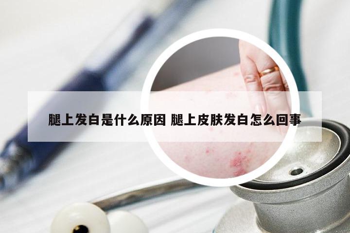 腿上发白是什么原因 腿上皮肤发白怎么回事