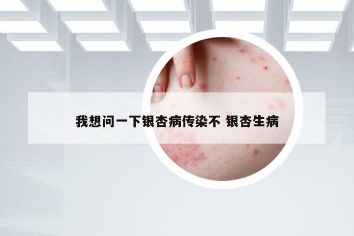我想问一下银杏病传染不 银杏生病