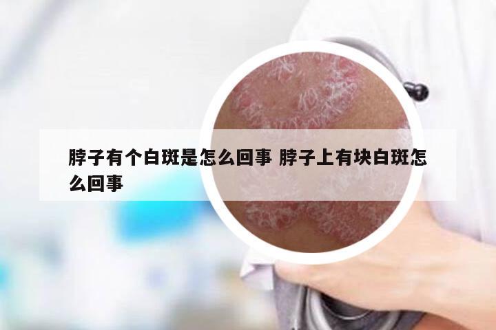 脖子有个白斑是怎么回事 脖子上有块白斑怎么回事