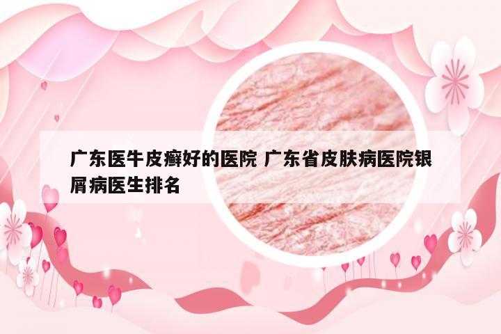 广东医牛皮癣好的医院 广东省皮肤病医院银屑病医生排名