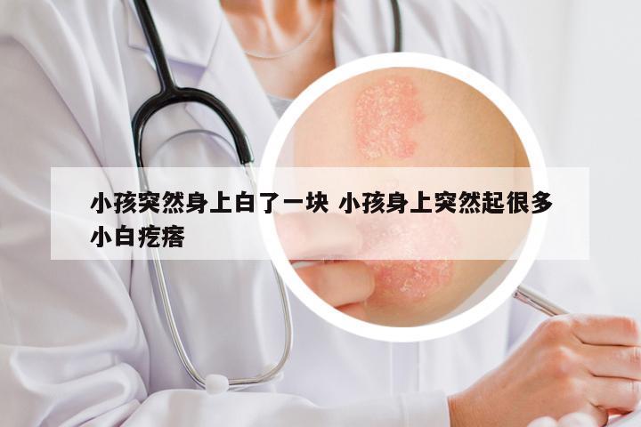 小孩突然身上白了一块 小孩身上突然起很多小白疙瘩