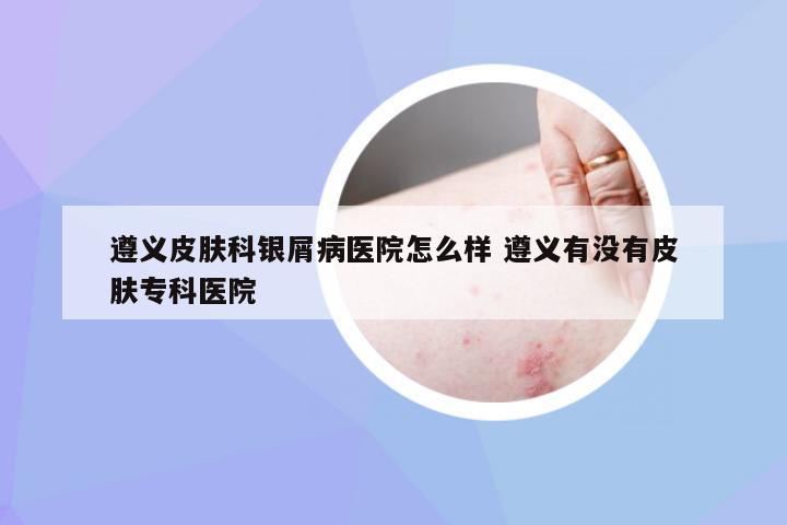 遵义皮肤科银屑病医院怎么样 遵义有没有皮肤专科医院