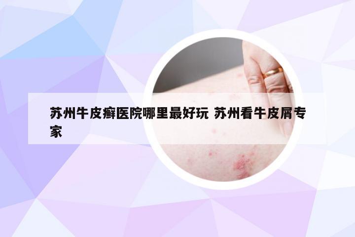 苏州牛皮癣医院哪里最好玩 苏州看牛皮屑专家