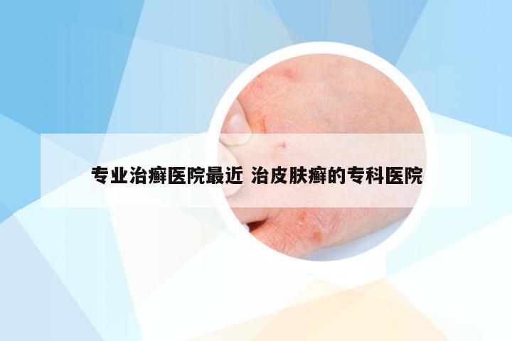 专业治癣医院最近 治皮肤癣的专科医院