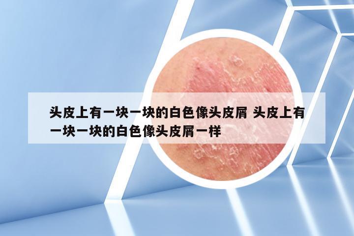 头皮上有一块一块的白色像头皮屑 头皮上有一块一块的白色像头皮屑一样