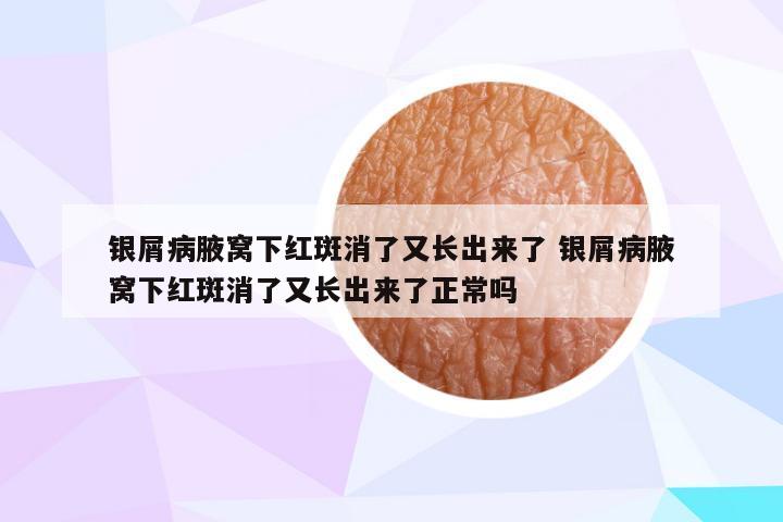 银屑病腋窝下红斑消了又长出来了 银屑病腋窝下红斑消了又长出来了正常吗