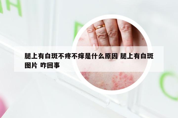 腿上有白斑不疼不痒是什么原因 腿上有白斑图片 咋回事