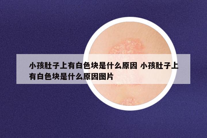 小孩肚子上有白色块是什么原因 小孩肚子上有白色块是什么原因图片