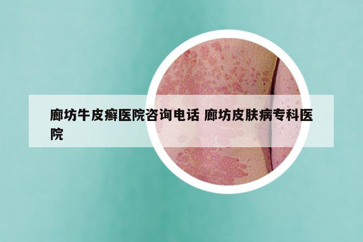 廊坊牛皮癣医院咨询电话 廊坊皮肤病专科医院