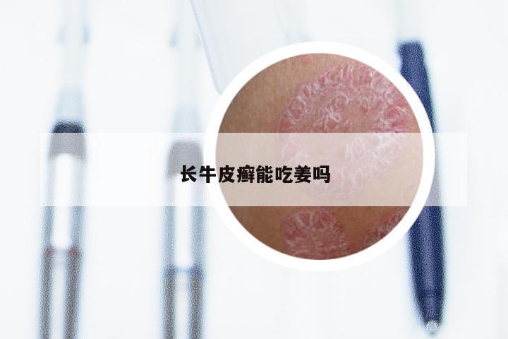 长牛皮癣能吃姜吗