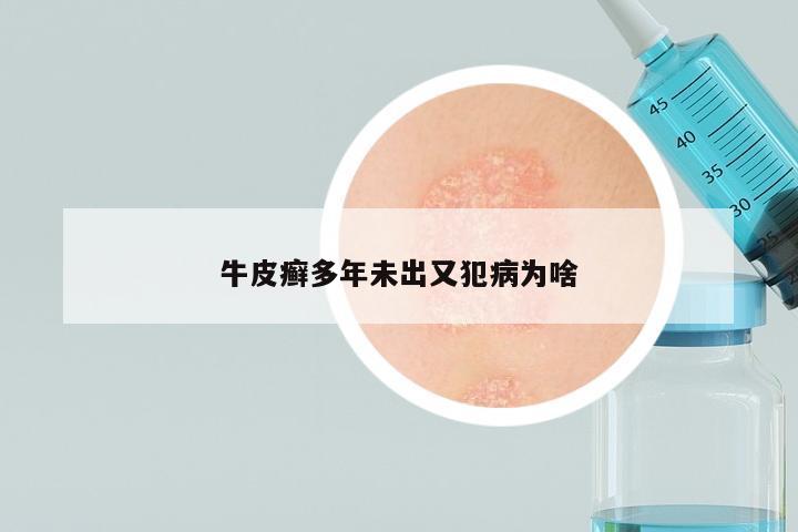 牛皮癣多年未出又犯病为啥