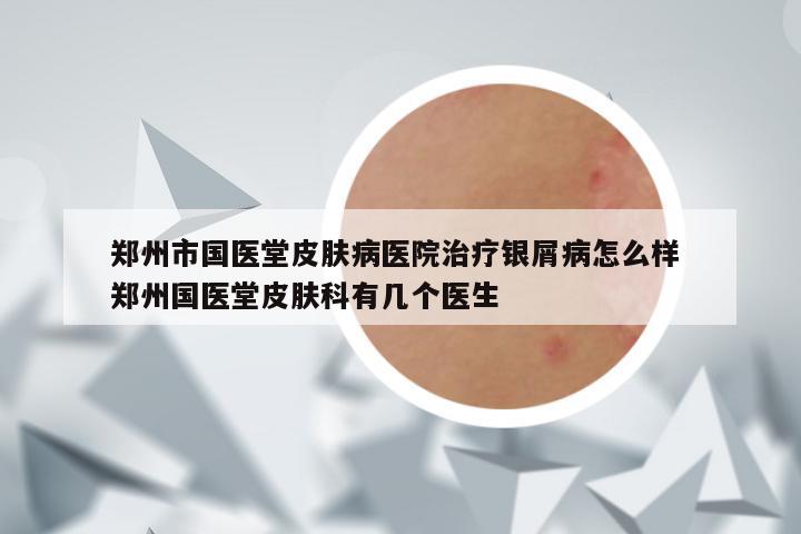 郑州市国医堂皮肤病医院治疗银屑病怎么样 郑州国医堂皮肤科有几个医生