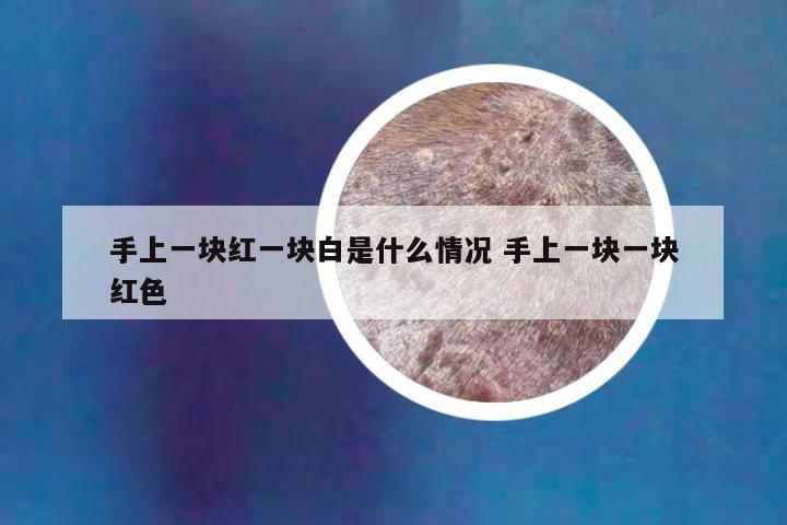 手上一块红一块白是什么情况 手上一块一块红色