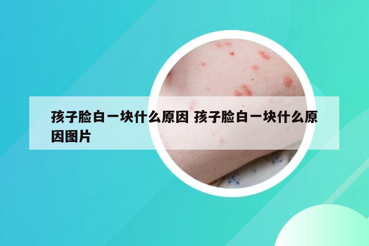 孩子脸白一块什么原因 孩子脸白一块什么原因图片