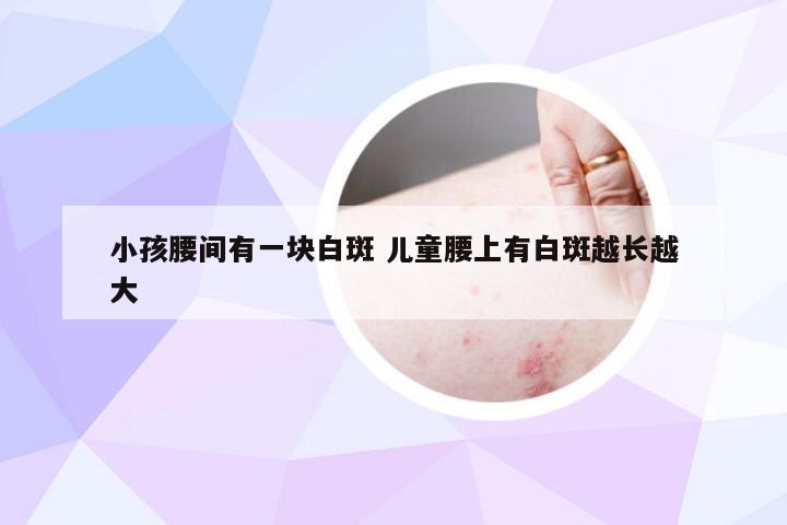 小孩腰间有一块白斑 儿童腰上有白斑越长越大