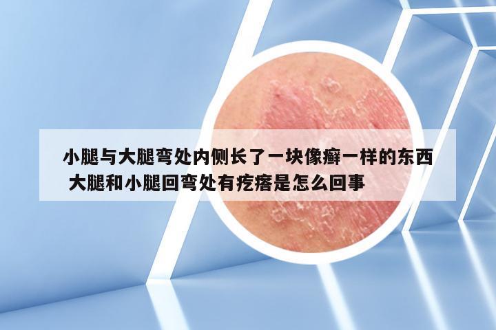 小腿与大腿弯处内侧长了一块像癣一样的东西 大腿和小腿回弯处有疙瘩是怎么回事