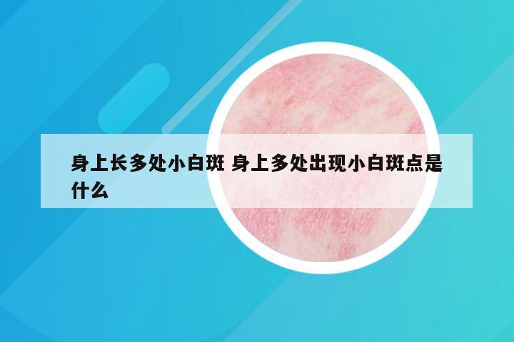 身上长多处小白斑 身上多处出现小白斑点是什么