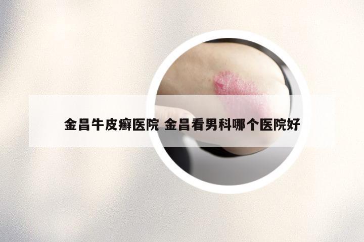 金昌牛皮癣医院 金昌看男科哪个医院好