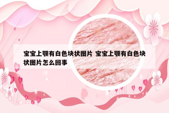 宝宝上颚有白色块状图片 宝宝上颚有白色块状图片怎么回事