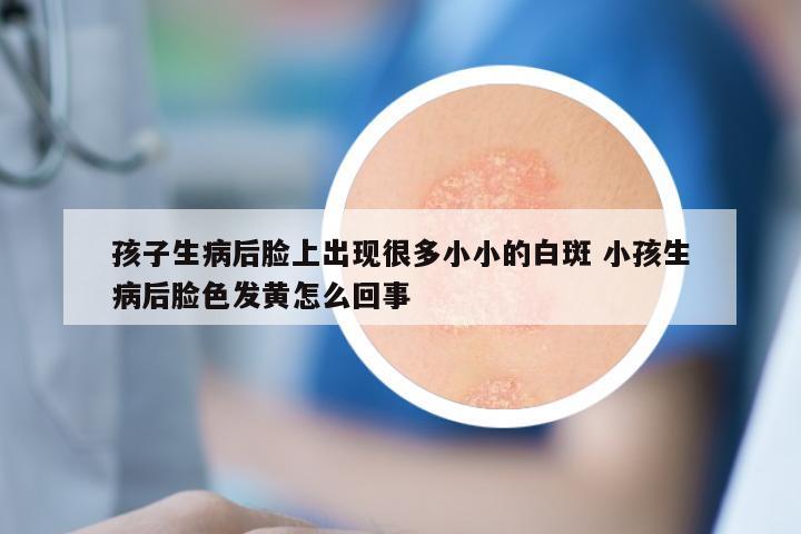 孩子生病后脸上出现很多小小的白斑 小孩生病后脸色发黄怎么回事