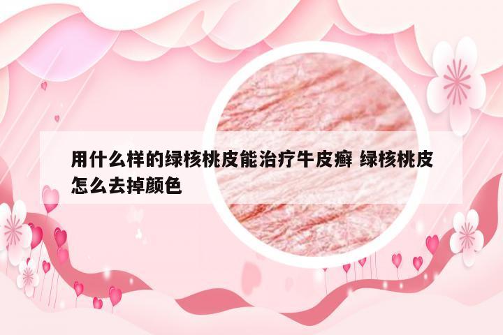 用什么样的绿核桃皮能治疗牛皮癣 绿核桃皮怎么去掉颜色