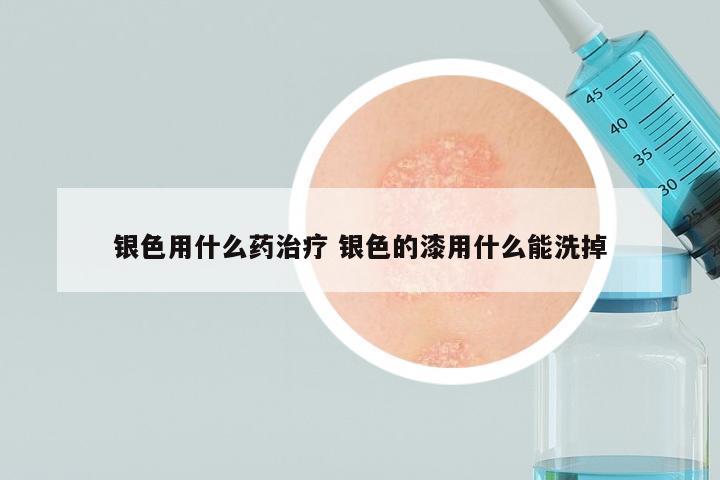 银色用什么药治疗 银色的漆用什么能洗掉