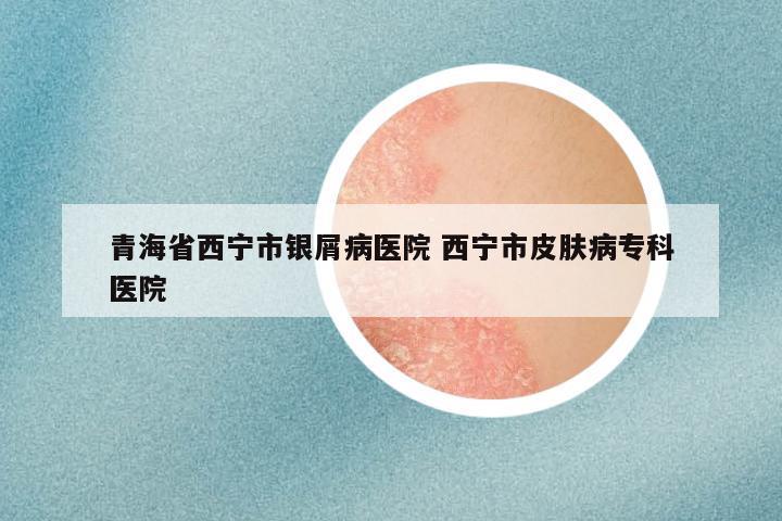 青海省西宁市银屑病医院 西宁市皮肤病专科医院