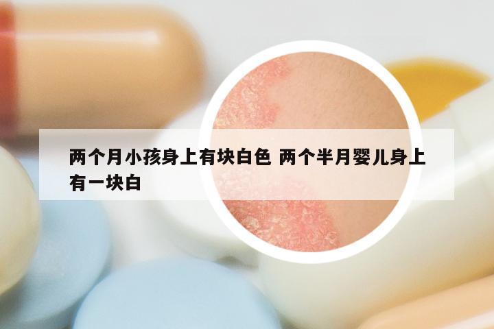 两个月小孩身上有块白色 两个半月婴儿身上有一块白