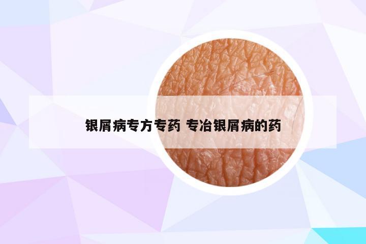 银屑病专方专药 专冶银屑病的药