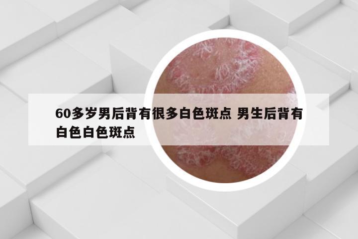 60多岁男后背有很多白色斑点 男生后背有白色白色斑点