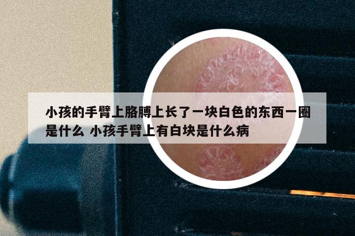 小孩的手臂上胳膊上长了一块白色的东西一圈是什么 小孩手臂上有白块是什么病
