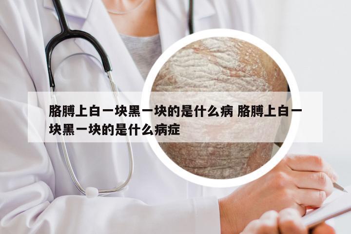胳膊上白一块黑一块的是什么病 胳膊上白一块黑一块的是什么病症