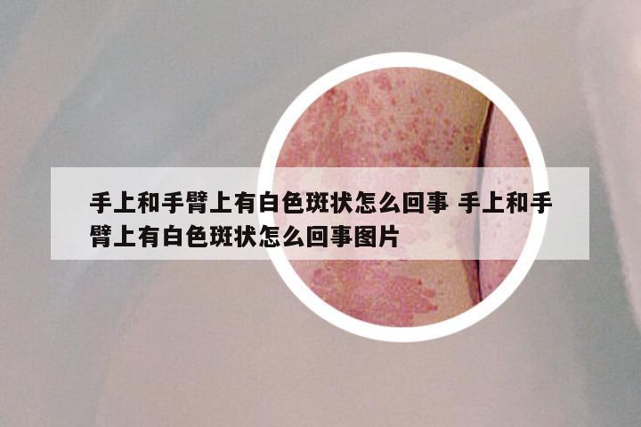 手上和手臂上有白色斑状怎么回事 手上和手臂上有白色斑状怎么回事图片
