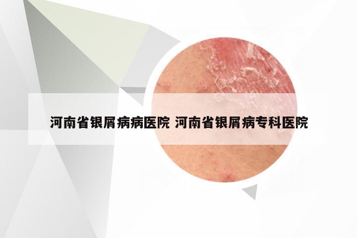 河南省银屑病病医院 河南省银屑病专科医院