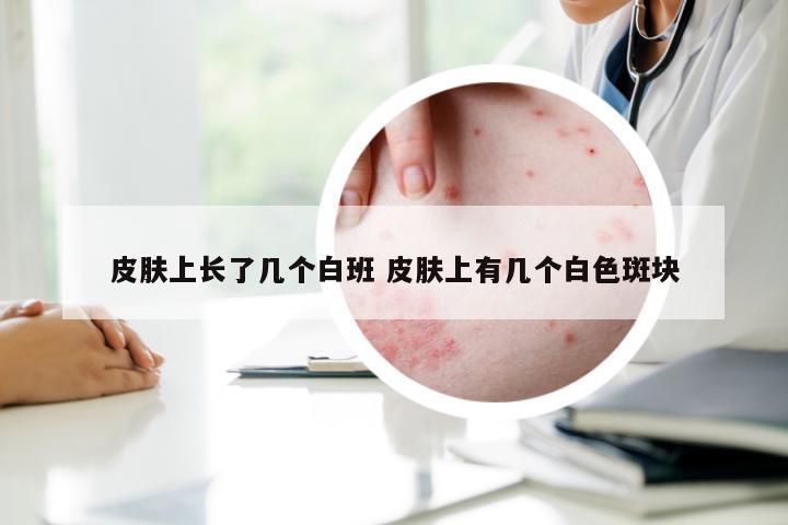 皮肤上长了几个白班 皮肤上有几个白色斑块